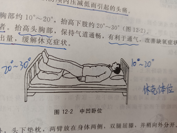大S為何常臥？深度剖析其背后的多重原因與健康管理之道